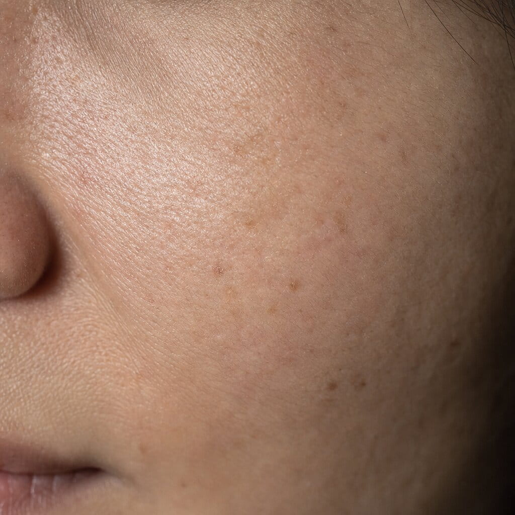 Macro close-up of skin showing texture, fine lines and hyperpigmentation