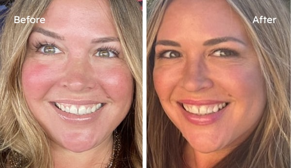 Customer Ally before and after results