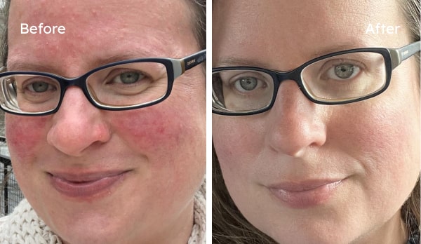 Customer Brittany before and after results