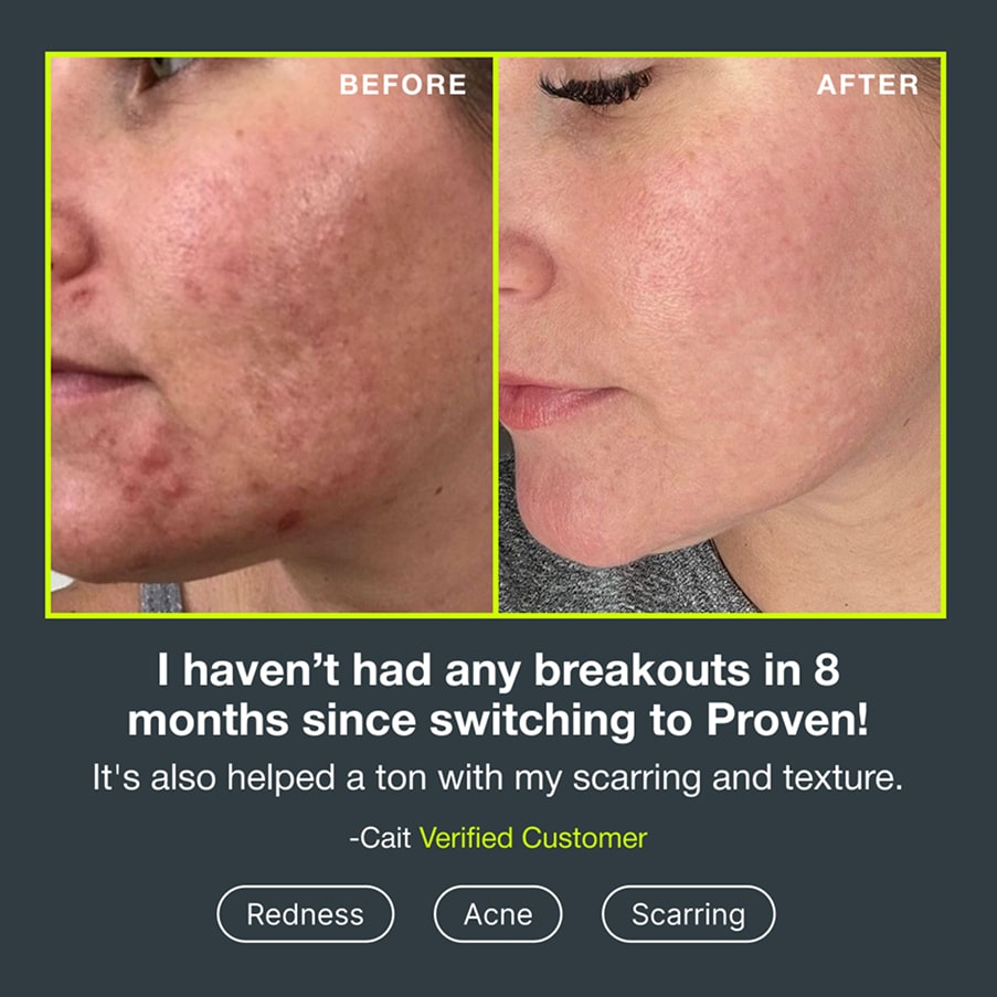 Before and after photographs of a customer’s cheek showing fewer breakouts, quoted: “I haven’t had any breakouts in 8 months since switching to Proven! It’s also helped a ton with my scarring and texture.” — Cait, verified customer, for redness, acne and scarring