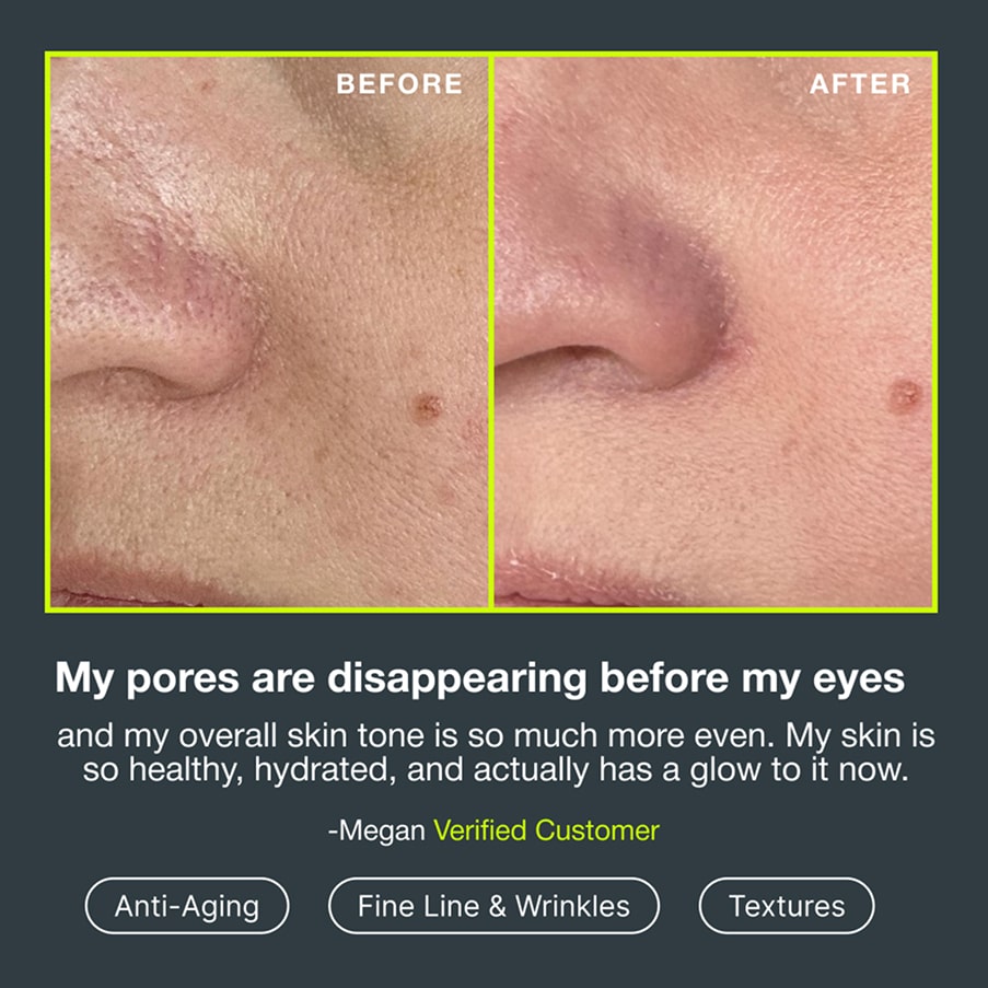 Before and after photographs of a customer’s nose and cheek showing smaller-looking pores, quoted: “My pores are disappearing before my eyes, and my overall skin tone is so much more even. My skin is so healthy, hydrated, and actually has a glow to it now.” — Megan, verified customer, for anti-aging, fine lines and wrinkles, and texture